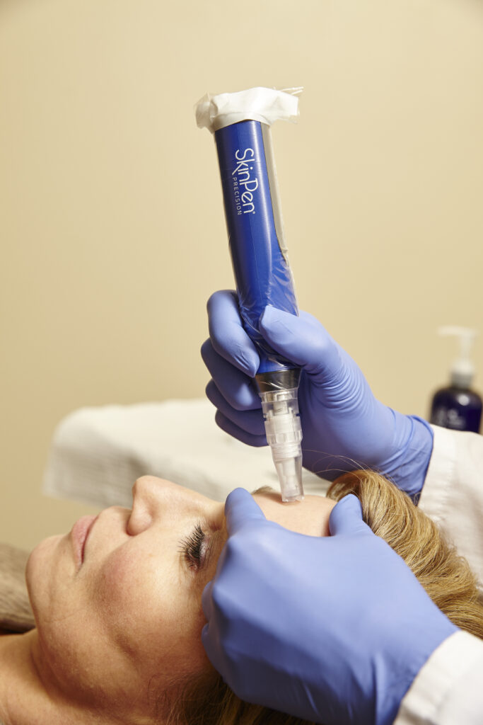 A pen being used on a woman's face